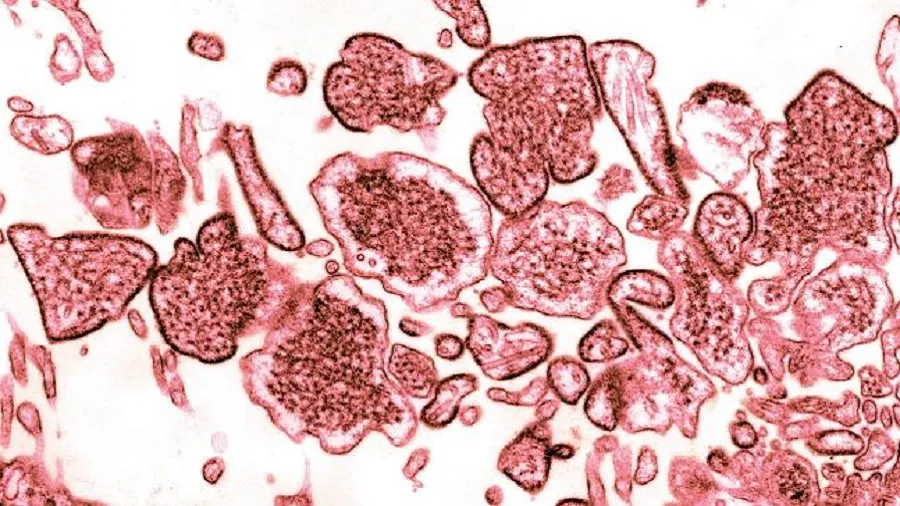 Nipah Virus: જાણો કેવી રીતે ફેલાય છે, શું છે લક્ષણો અને કેવી રીતે કરી શકાય બચાવ?