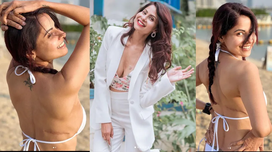 છવી મિત્તલે બિકીની પહેરી બતાવ્યા બ્રેસ્ટ કેન્સરની સર્જરીના નિશાન