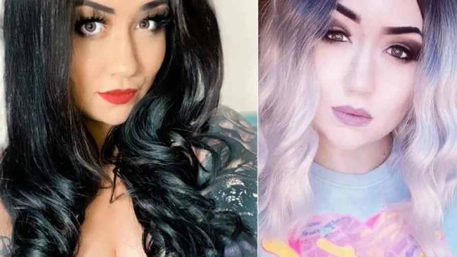 આ એલર્જીને કારણે દર 3 મિનિટમાં બેભાન થાય છે મહિલા, ડૉક્ટરો નથી જાણી શક્યા કારણ