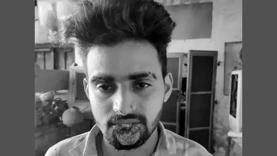 યુવક જબરદસ્તી KISS કરવા ગયો તો મહિલાએ દાંતથી તેનો હોઠ કાપી નાંખ્યો