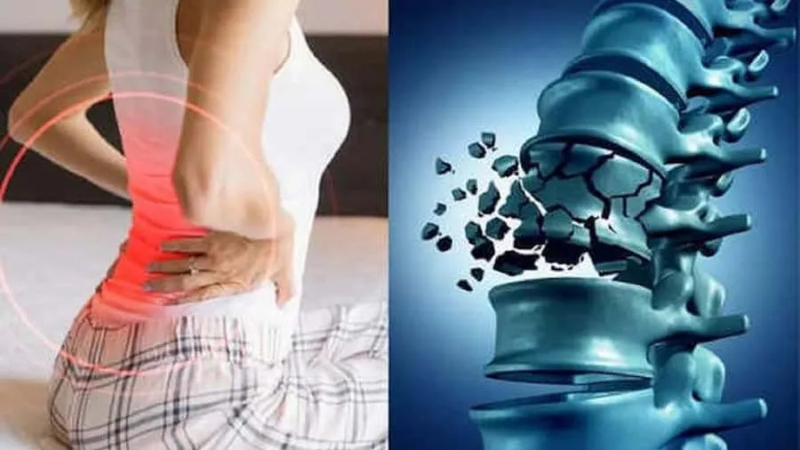 જ્યાં વધુ વાયુ પ્રદૂષણ, ત્યાં વધુ તૂટી રહ્યા છે હાડકાં, નવી સ્ટડીમાં ખુલાસો