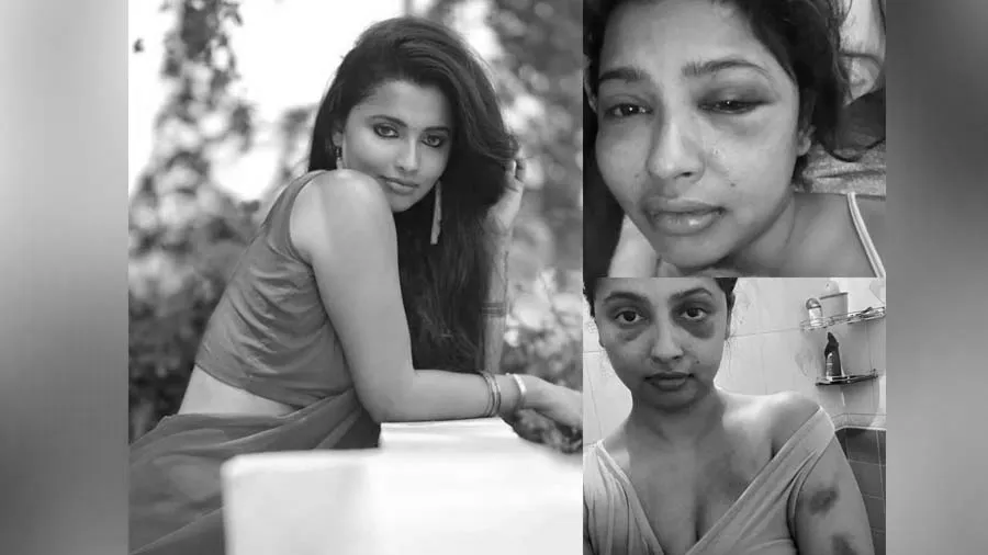 અનિકાને બોયફ્રેન્ડે માર્યો માર, એક્ટ્રેસે શેર કરી તસવીરો