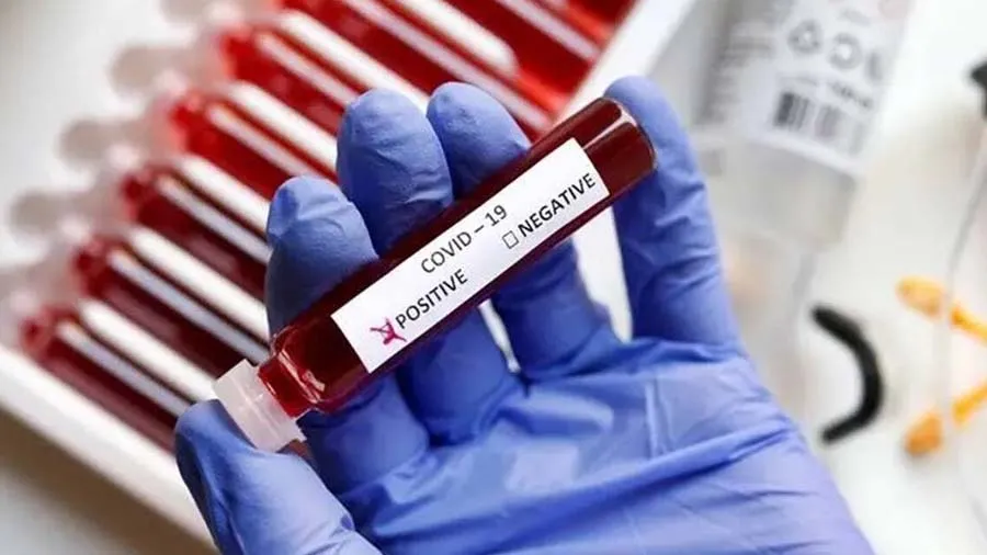 દેશમાં મળ્યો કોવિડનો XBB1.16 વેરિયન્ટ, આ રાજ્યોમાં ઝડપથી ફેલાઇ રહ્યુ છે સંક્રમણ