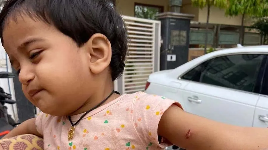 ઘર બહાર રમતી છોકરીને ખેચી લઈ જઇ રહ્યું હતું કુતરું, બચાવવા જતા દાદા ઇજાગ્રસ્ત