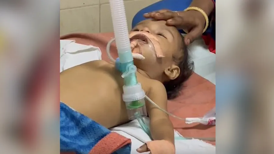 સુરત: 1 વર્ષની દીકરી એસિડને પાણી સમજીને પી ગઇ, 5 દિવસની સારવાર પછી દમ તોડ્યો