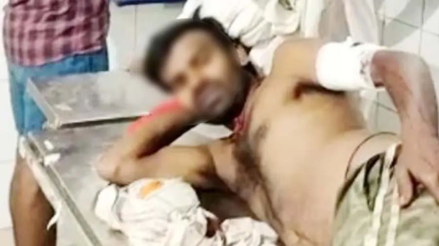 ભાભીએ વાત કરવાની બંધ કરી તો નાના ભાઈએ મોટા ભાઈના પ્રાઇવેટ પાર્ટમાં માર્યો છરો