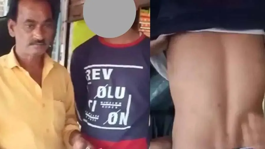 'સગીર બાળકના ગુપ્તાંગમાં સ્ટમ્પ નાખ્યું', UP પોલીસ પર થર્ડ ડિગ્રી ટોર્ચરનો આરોપ