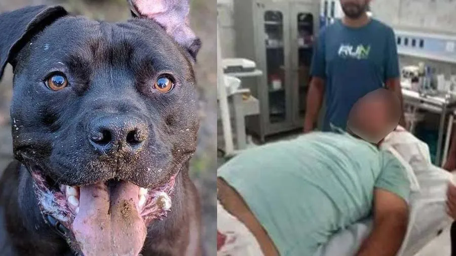 કૂતરાએ વ્યક્તિના પ્રાઇવેટ પાર્ટ પર કરી દીધો હુમલો, મુશ્કેલીથી બચ્યો જીવ