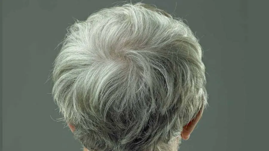 ખબર પડી ગઈ વાળ સફેદ કેમ થાય છે, વૈજ્ઞાનિકો ગ્રે વાળને ફરી કાળા કરવાનો ઉપાય શોધશે