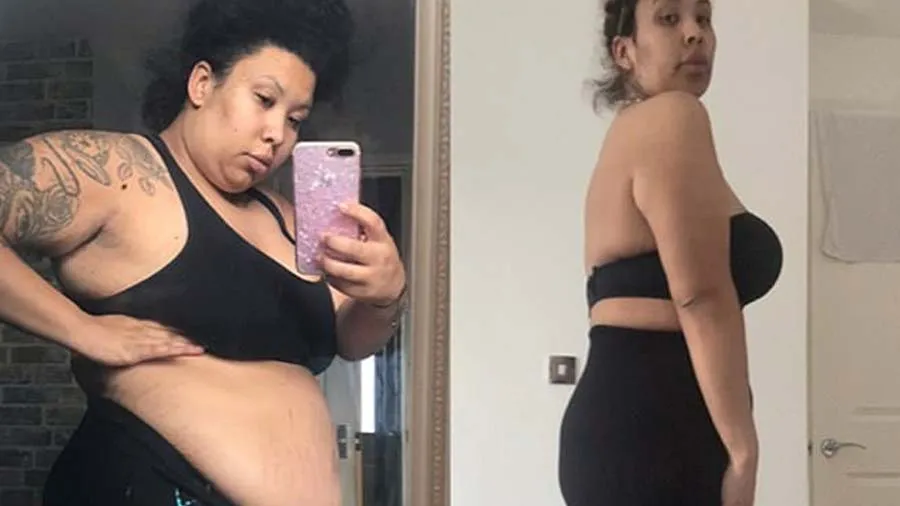 139 કિલોની મહિલા, સર્જરી પાછળ 3 લાખ ખર્ચી 50 કિલો વજન કર્યું ઓછું પણ...