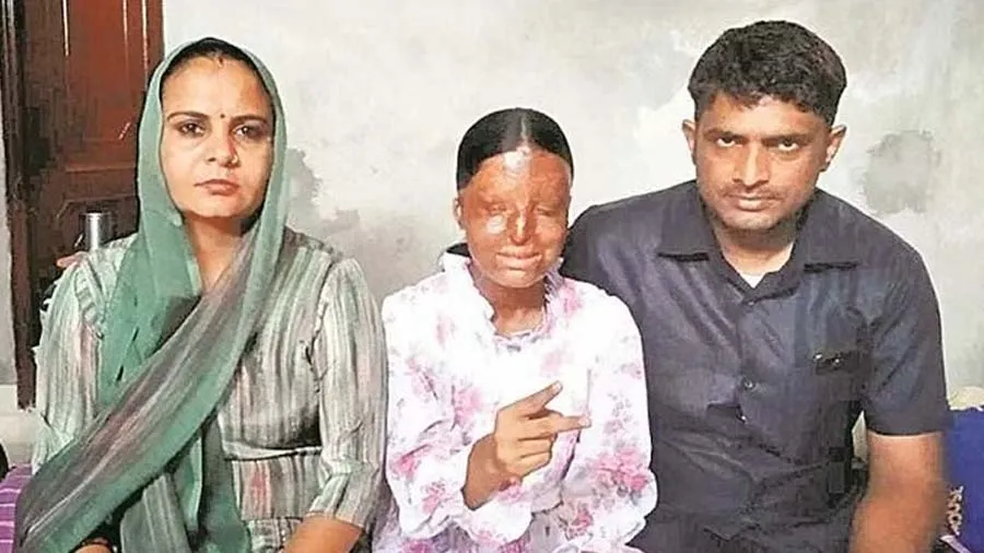 3 વર્ષની ઉંમરે એસિડ એટેક તેના ઉત્સાહને રોકી શક્યો નહીં, 10 બોર્ડમાં 95% સ્કોર