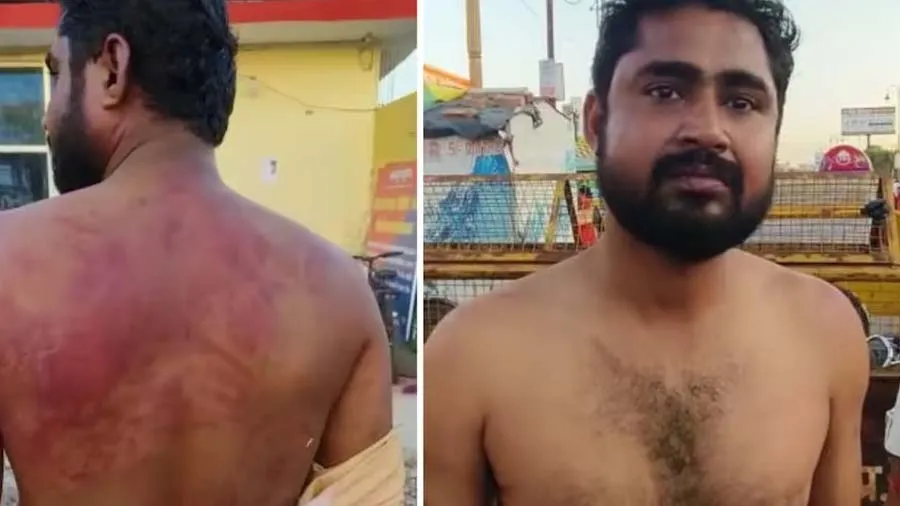 જુનિયર તબીબોની ગુંડાગીરી, ડિસ્ચાર્જ માગતા દર્દીને હોસ્પિટલમાં ઢોરમાર માર્યો