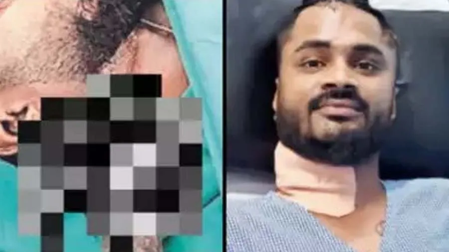 ભાઈએ ગળા પર છરી ઝીંકી, એ જ હાલતમાં યુવક 1 Km સુધી બાઈક ચલાવી હોસ્પિટલ પહોંચ્યો