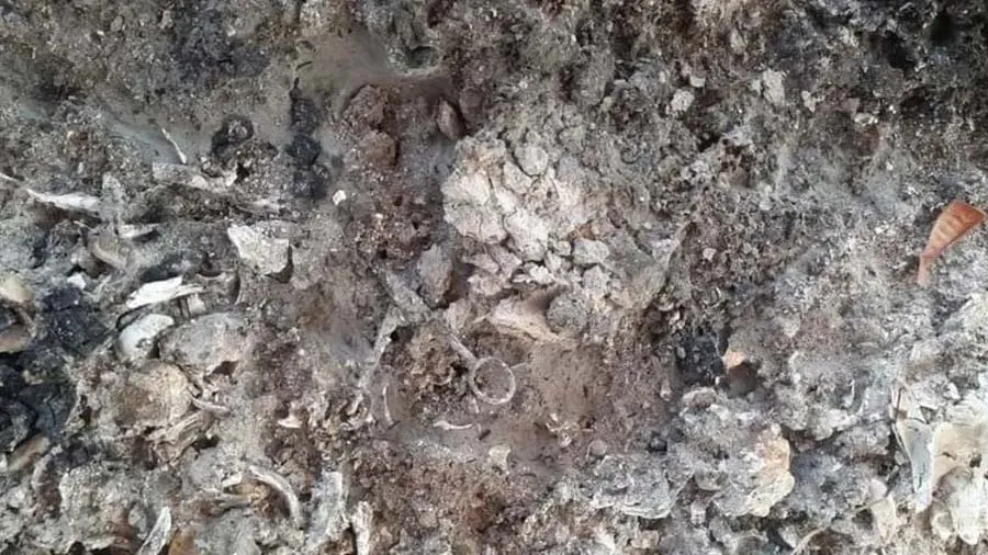 અસ્થિ ભેગા કરતા વખતે મળી કાતર, પુત્રનો આરોપ ડૉક્ટરે પેટમાં છોડી દીધી હતી