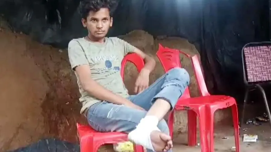 પગમાંથી લોહી નીકળતું રહ્યું, 270 રૂપિયા મળ્યા ત્યારે ડોક્ટરે ટાંકા લગાવ્યા