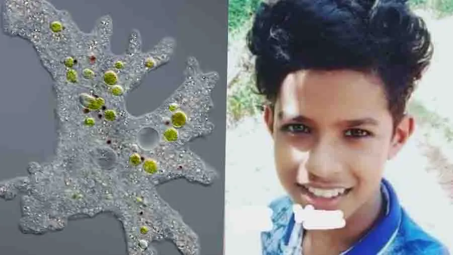 મગજ ખાનારા અમીબાથી 15 વર્ષના યુવકનું મોત, નહાતી વખતે નાકના રસ્તે શરીરમાં પ્રવેશ