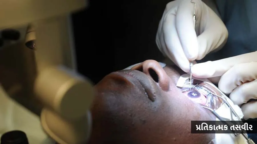 મોતિયાના ઓપરેશન બાદ ચાલી ગઈ 18 લોકોની આંખની દ્રષ્ટિ, મંત્રીએ કહ્યું- ડૉક્ટરની ભૂ