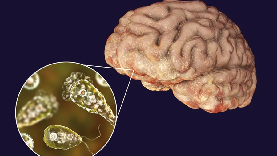 પાકિસ્તાનીઓના મગજને સડાવી રહી છે આ ઘાતક અમીબા, 11ના મોત, શું ભારતમાં?