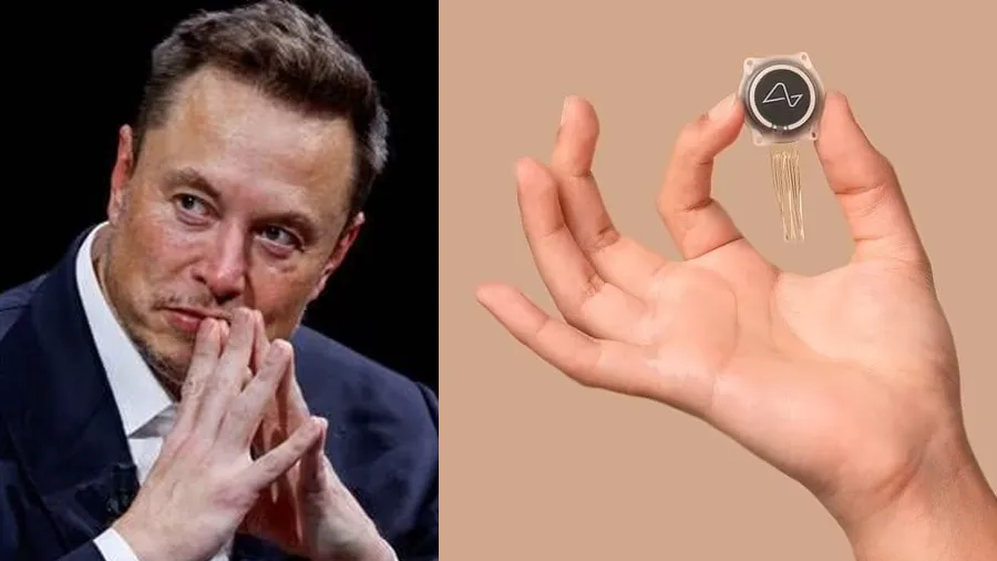 અમેરિકાની મંજૂરી, માણસના મગજમાં લાગશે એલન મસ્કની ચિપ, હજારો લોકો તૈયાર