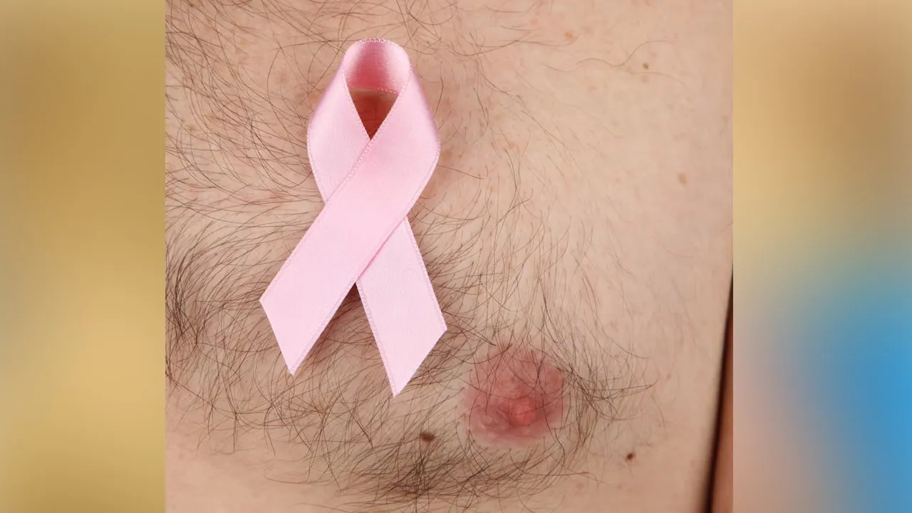 Male-Breast-Cancer2 