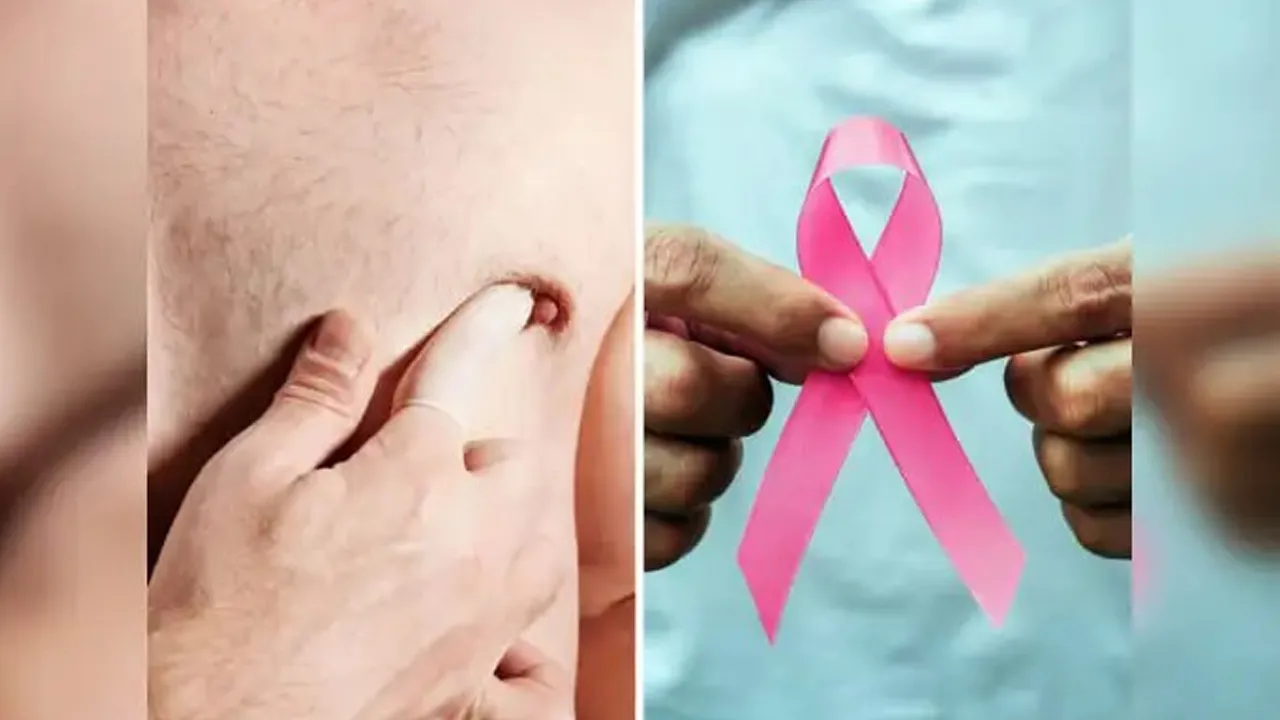 Male-Breast-Cancer3 