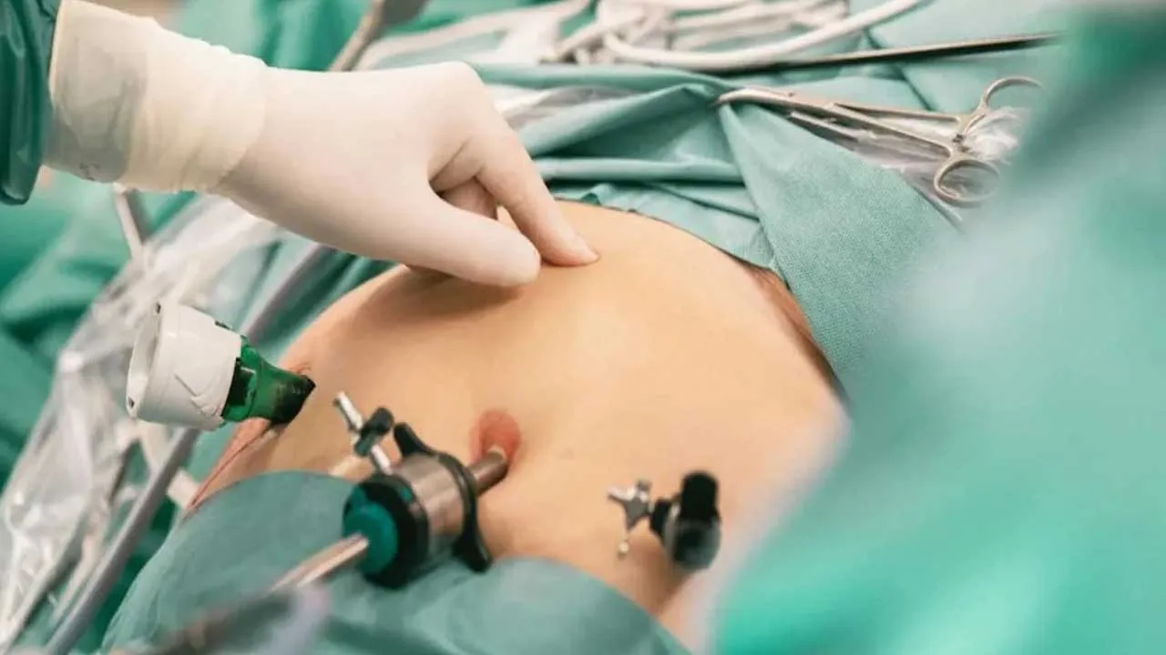 Woman, Bariatric Surgery