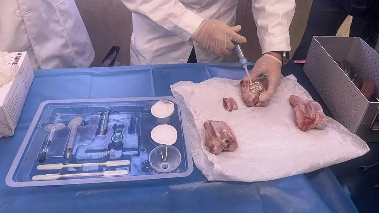 ચીને બનાવ્યો દુનિયાનો પહેલો 'હાડકાનો ગુંદર', તૂટેલા હાડકા 2-3 મિનિટમાં જોડાઈ જશે, સર્જરી...