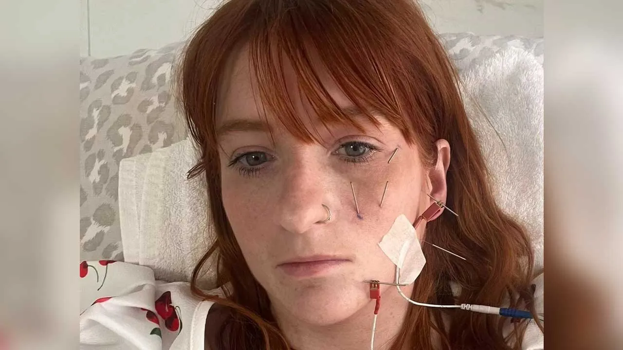 Woman Face Paralyzed