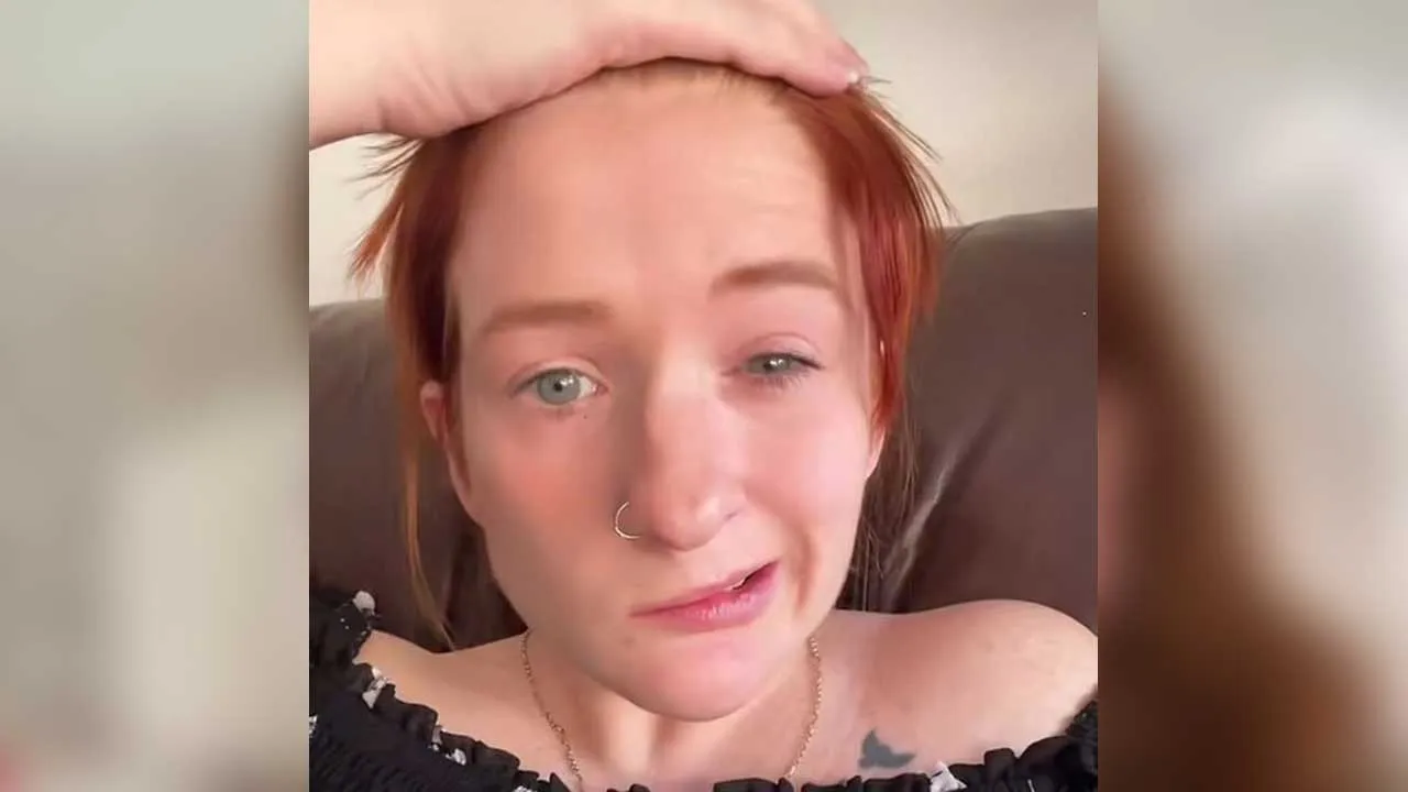 Woman Face Paralyzed