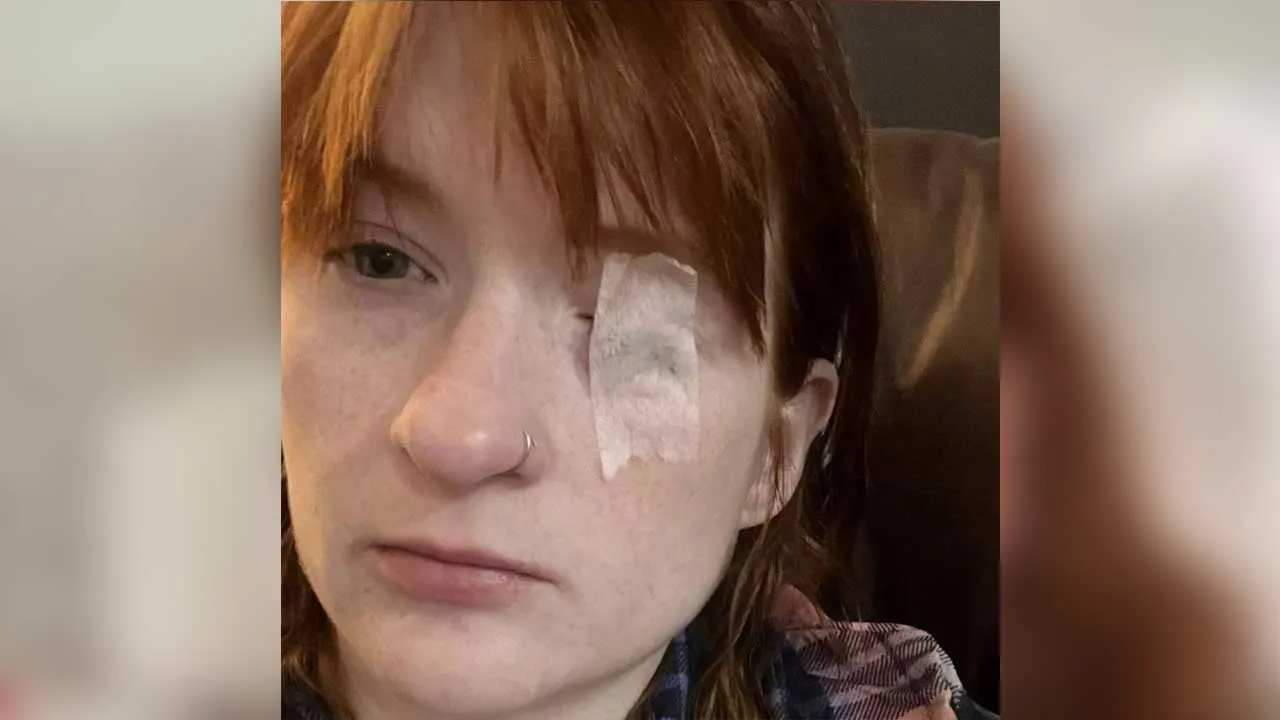 Woman Face Paralyzed