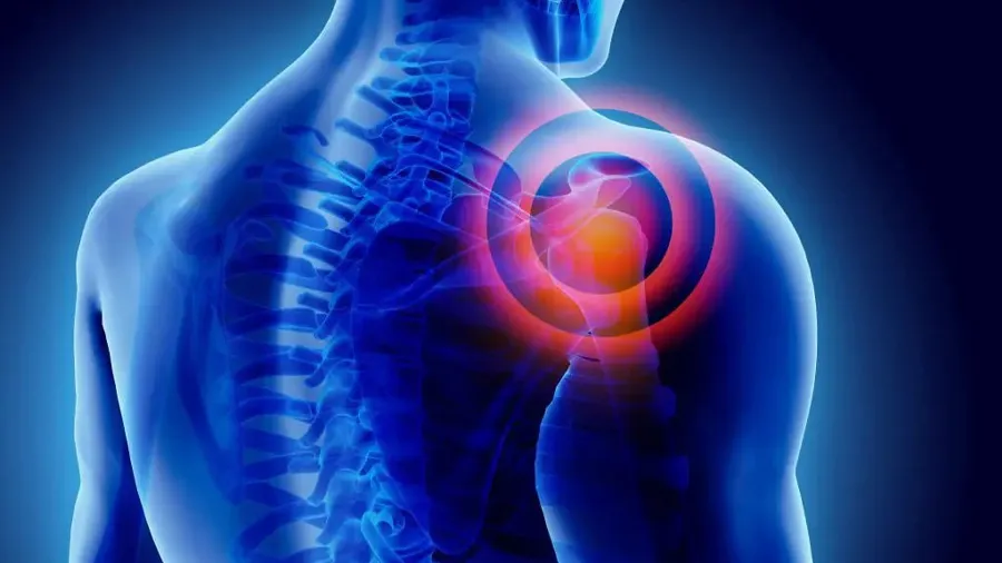 Spleen-Laceration.jpg-3