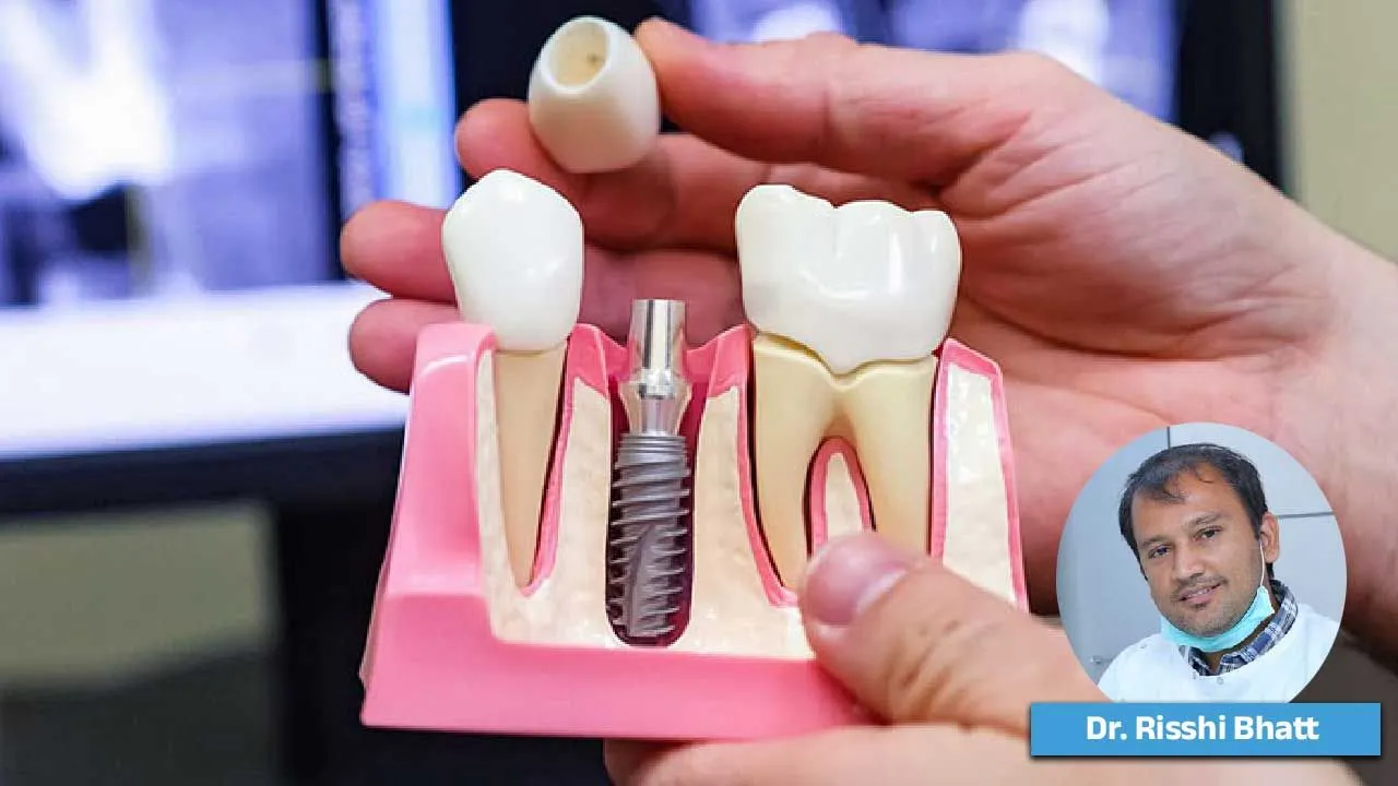 પડી ગયેલો માત્ર એક દાંત પણ તમને મોટા ખર્ચામાં ઉતારી શકે છે