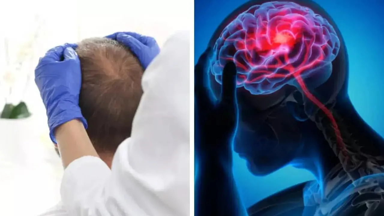 Head-Massage-Brain-Stroke2 