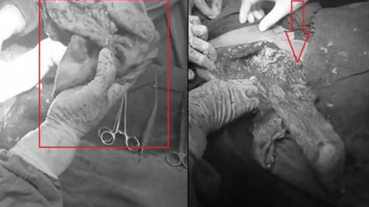 Hospital-Negligence3 