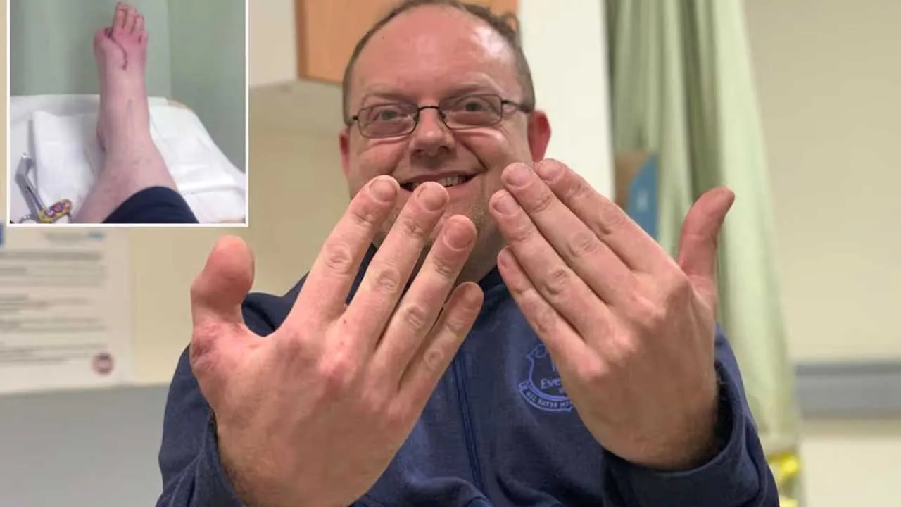 હાથમાં ડોક્ટરોએ લગાવી દીધો પગનો અંગૂઠો