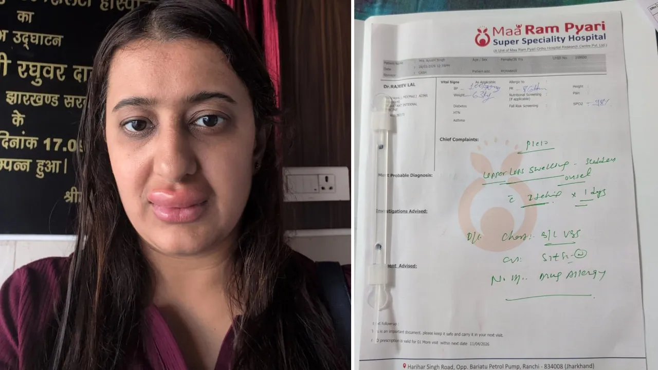 મહિલાનો દાવો- ‘વંદે ભારતનું ભોજન ખાઈને મારા હોઠ સોજી ગયા’, IRCTCએ પણ આપી પ્રતિક્રિયા