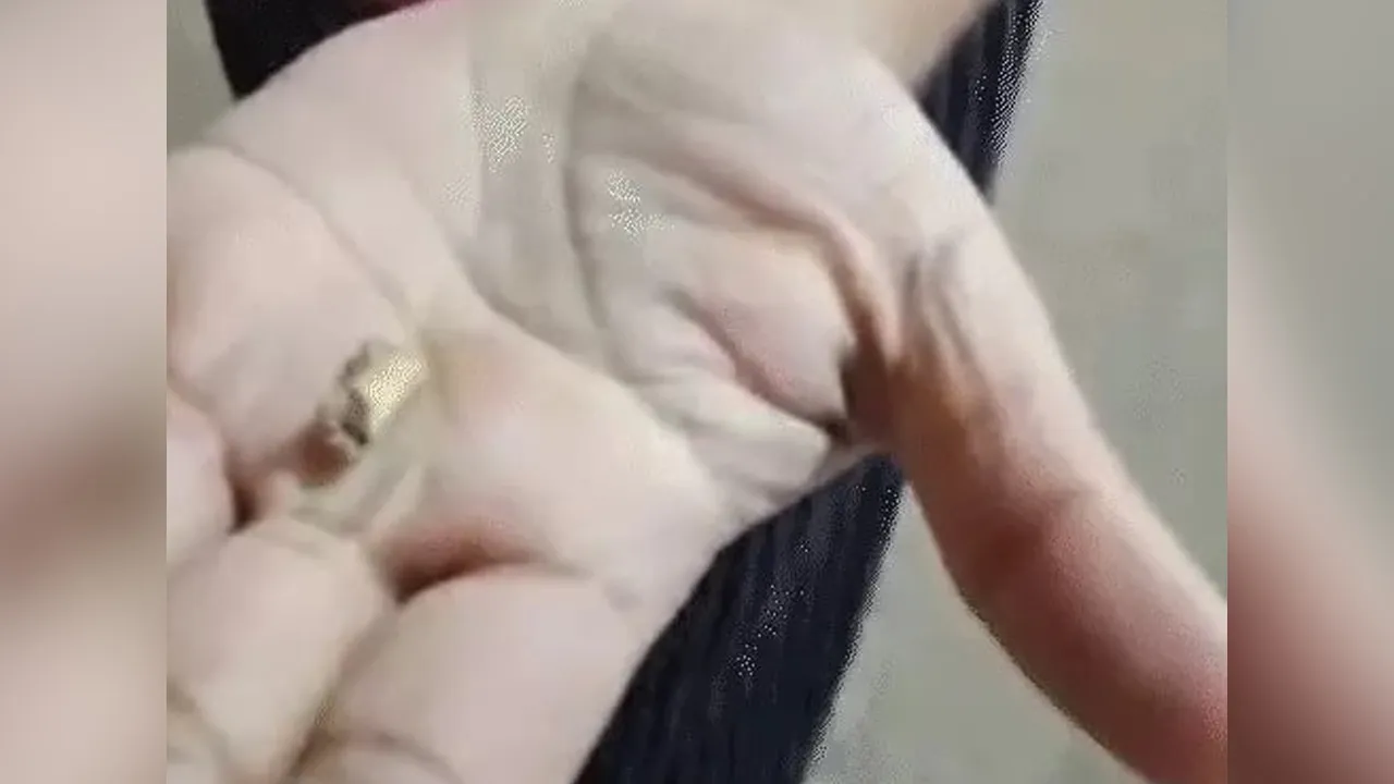 bone 