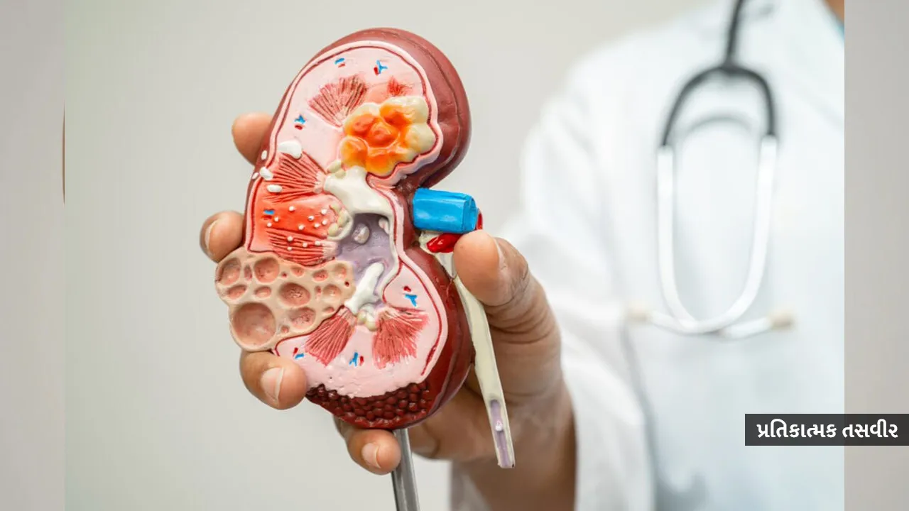 Kidney1 