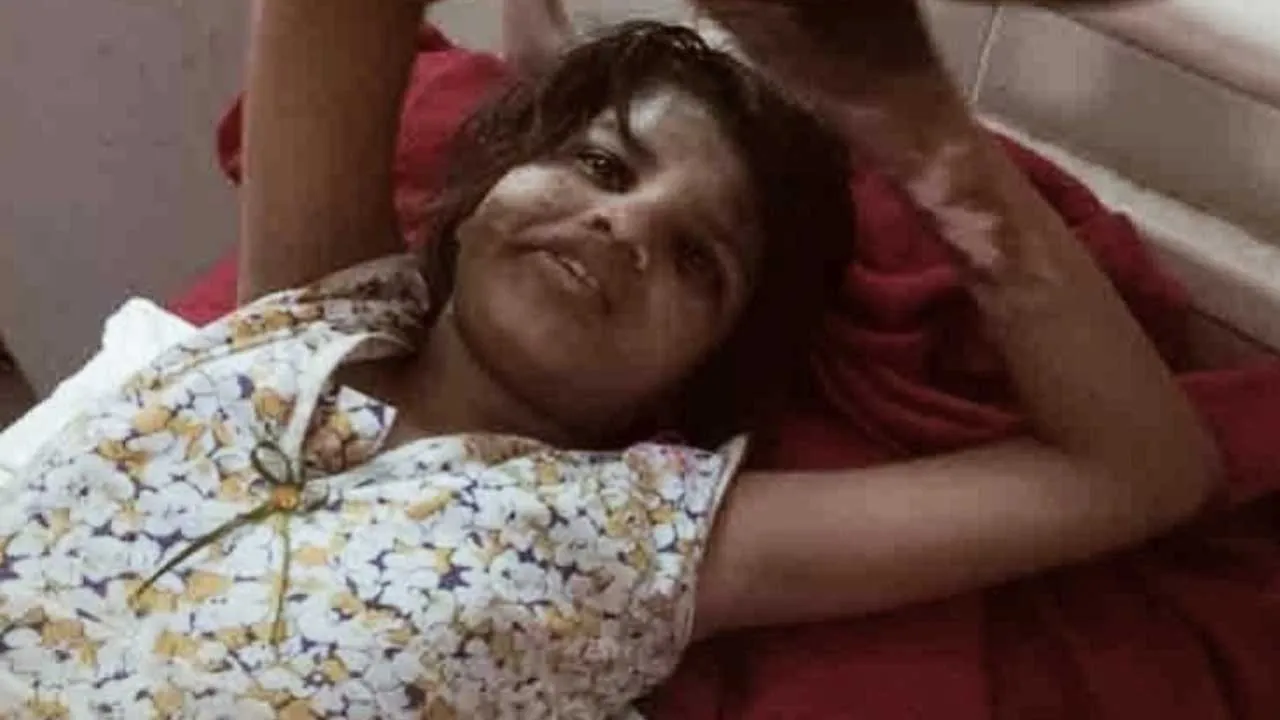 Mowgli Girl Dies
