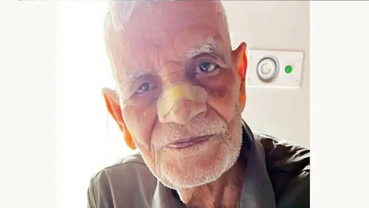 Rat Bites Nose