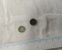 માતા-પિતા માટે લાલબત્તી સમાન કિસ્સો, 5 મહિનાના બાળકે રમતા-રમતા ગળી લીધો હતો બટન સેલ, પછી...