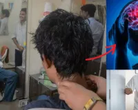 વાળંદની માલિશ કરવાથી યુવાનો બની રહ્યા છે સ્ટ્રોકનો ભોગ! ન્યુરોલોજીસ્ટે આખી વાત સમજાવી