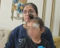 બાળકની આંખ પાસે ઇજા થઈ તો ડૉક્ટરે ટાંકા લગાવવાની જગ્યાએ ફેવિક્વીકથી ઘા ભરી દીધો