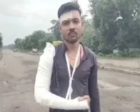 રસ્તાના ખાડાથી અકસ્માત થયો તો આ યુવાન 111 દિવસ લડ્યો, NHAI સામે ગુનો નોંધાયો