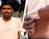 ખેડૂતે વ્યાજે 1 લાખ લીધેલા અને થઈ ગયા 74 લાખ, જગતના તાતે દેવું ચૂકવવા વેચવી પડી કિડની