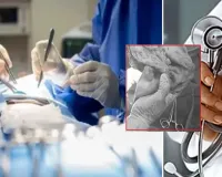 હોસ્પિટલમાં સર્જરી પછી મહિલાના પેટમાં અડધો મીટર કપડું છૂટી ગયું... ડોક્ટર અને CMO સહિત 6 સામે FIR થઇ!