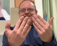 હાથમાં ડોક્ટરોએ લગાવી દીધો પગનો અંગૂઠો