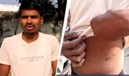 ખેડૂતે વ્યાજે 1 લાખ લીધેલા અને થઈ ગયા 74 લાખ, જગતના તાતે દેવું ચૂકવવા વેચવી પડી કિડની