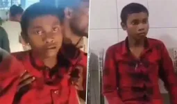 કૂતરા કરડ્યાના 4 મહિના પછી 17 વર્ષના છોકરાની હાલત બગડી, ભસવાનું ચાલુ કરી દીધું!