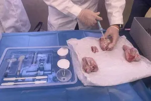 ચીને બનાવ્યો દુનિયાનો પહેલો 'હાડકાનો ગુંદર', તૂટેલા હાડકા 2-3 મિનિટમાં જોડાઈ જશે, સર્જરી...